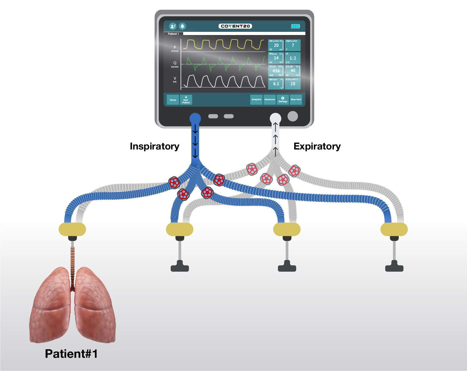 patient lung